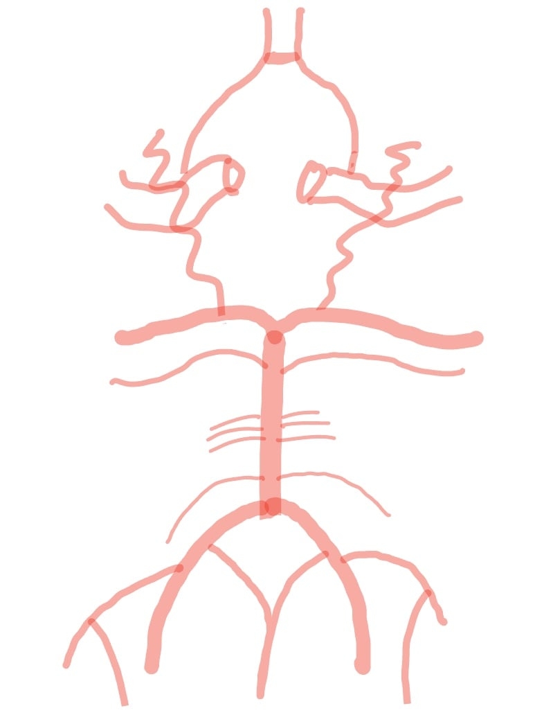 Circle Of Willis Template Notability Gallery